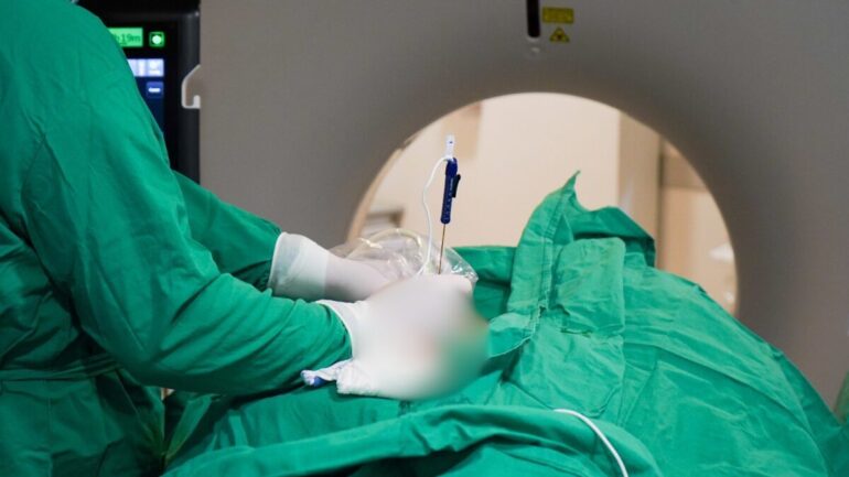 Técnica de electroporación irreversible en el Hospital Regional de Concepción